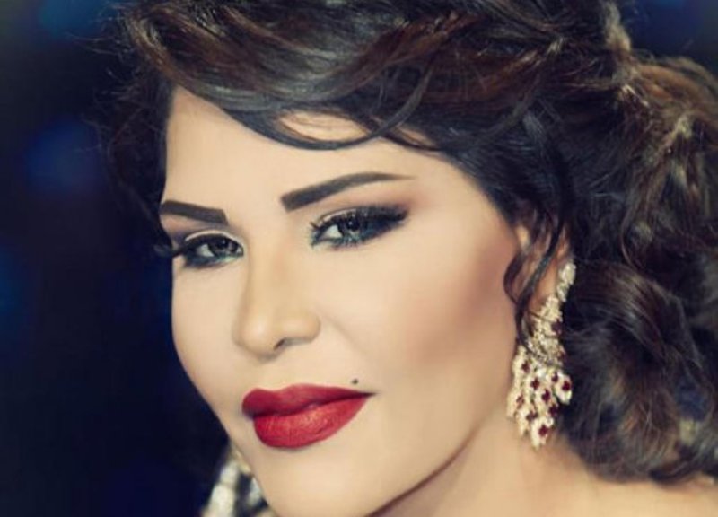 بالفيديو: الظهور الأول لأحلام في البروفات بعد كسر قدمها